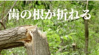 差し歯の根っこが折れて抜歯診断