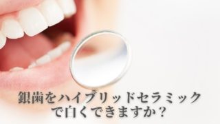 ハイブリッドセラミックとは「セラミック」ではなく「プラスチック」なんです。