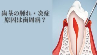 歯茎の腫れや炎症の原因は歯周病ですか？
