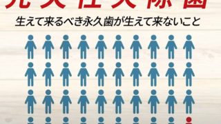 先天性欠除歯（生まれつき歯が生えない）は10人に1人です。