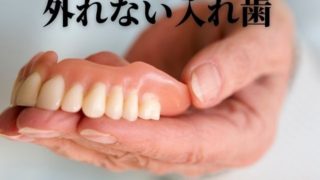外れない入れ歯のメインテナンス