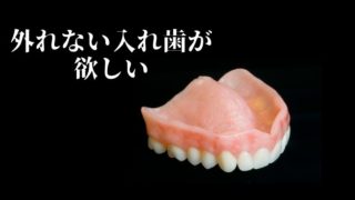 総入れ歯で悩んでいたことは忘れてしまった