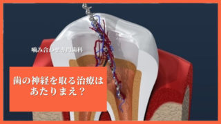 歯の神経を取る治療は「あたりまえ」？