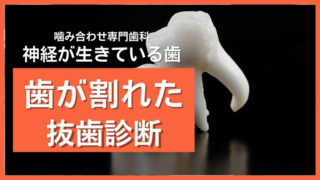 噛むと激痛！歯の根まで割れていた症例