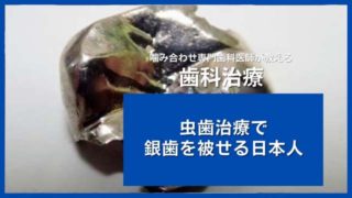 本当は怖い「銀歯」の被せ物