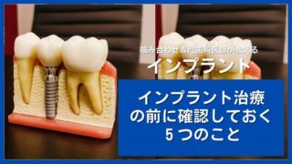 インプラント治療の前に知っておくこと
