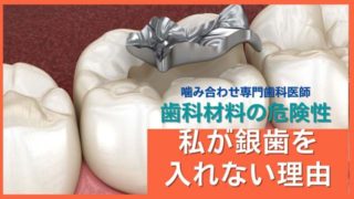 私が銀歯を口の中に入れたくない理由