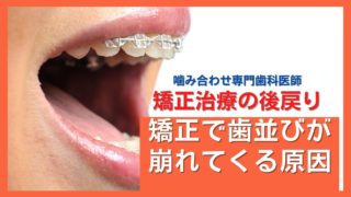 矯正治療で歯並びが崩れてくる原因「後戻り」
