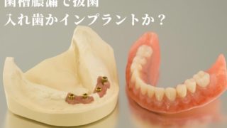 歯槽膿漏で抜歯。入れ歯かインプラントか？どちらがいい？