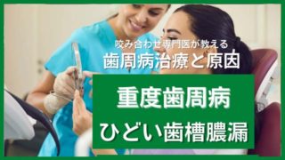 重度歯周病・ひどい歯槽膿漏の原因と治療