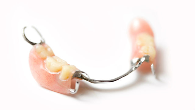 香川県・高松市で義歯・入れ歯をお探しなら吉本歯科医院