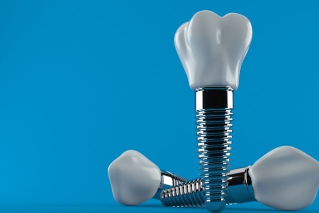 インプラントのトラブルは2年以内｜香川県高松市の吉本歯科医院