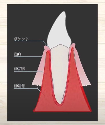 歯の神経のお痛みなら香川県高松市の歯の神経治療専門歯科 吉本歯科医院