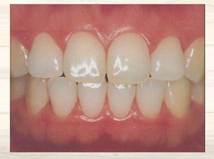 かみあわせ治療なら香川県 高松市 咬み合わせ専門歯科 吉本歯科医院