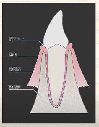 歯の神経のお痛みなら香川県高松市の歯の神経治療専門歯科 吉本歯科医院