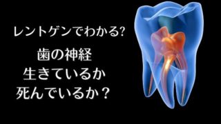 歯の神経が死んでいるか生きているか？判断はどうする？￼