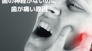 歯の神経がない歯が噛むと痛い原因