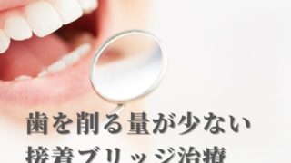 接着ブリッジ｜歯の削る量がとても少なくてすむ歯冠修復法