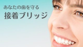 健康な歯を削りたくない方へ～削らず接着する「接着ブリッジ」治療