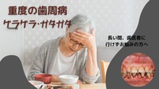 重度の歯周病|歯がグラグラ、ガタガタ、どんな状態でもご相談下さい