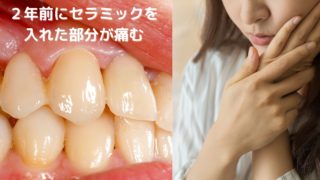 ２年前にセラミックを入れた部分が痛むというご相談
