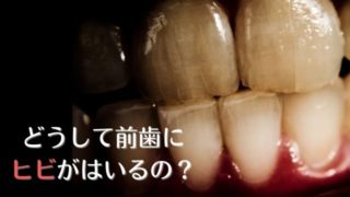 歯にヒビ・亀裂が入る原因