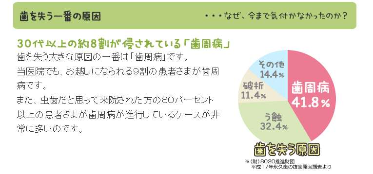 歯周病・歯槽膿漏の治療なら香川県高松市の吉本歯科医院