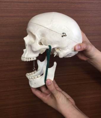 吉本歯科医院 インプラント 治療 患者様の体験談|香川県 高松市