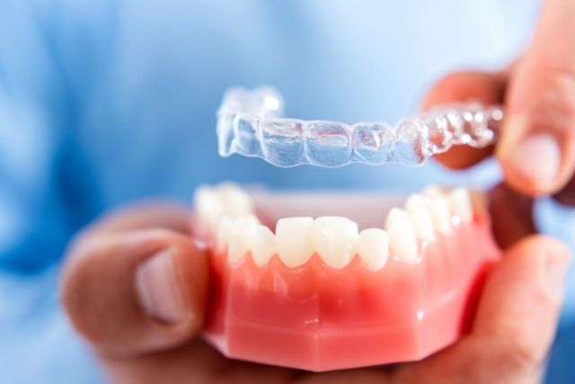 マウスピース矯正治療で多いご相談３つ