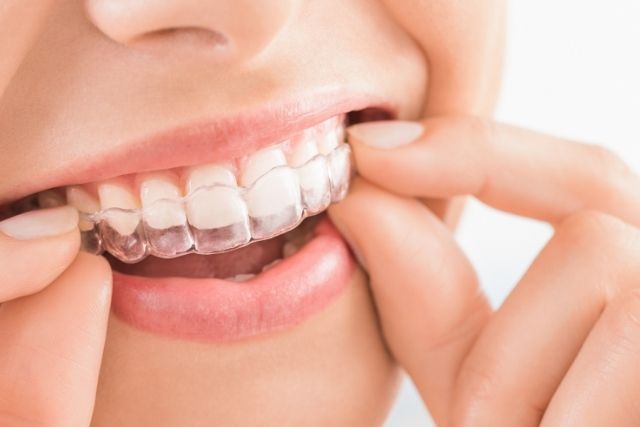 歯並び改善|高松市のマウスピース矯正なら吉本歯科医院