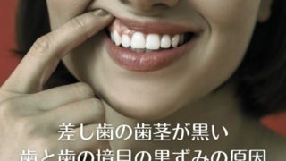 差し歯の歯茎が黒い・歯と歯茎の境い目が黒ずんでくる原因
