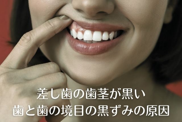 差し歯の歯茎が黒い・歯と歯茎の境目の黒ずみが気になる方へ｜高松市の吉本歯科医院