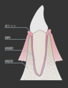 吉本歯科医院 インプラント 治療 患者様の体験談|香川県 高松市