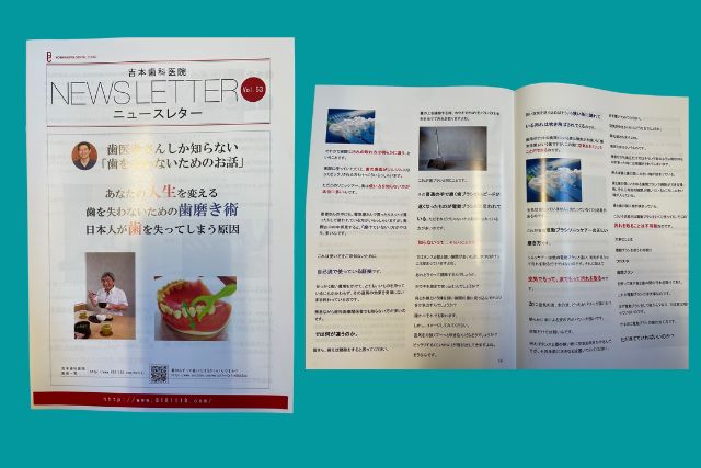 吉本歯科医院 インプラント 治療 患者様の体験談|香川県 高松市