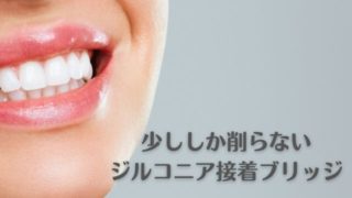 歯を少ししか削らないジルコニア接着ブリッジ