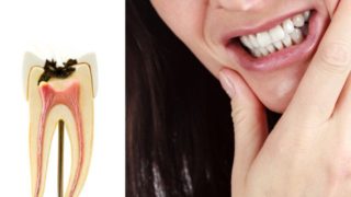 噛むと激痛が走る原因は歯根膜の炎症