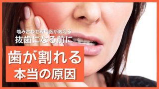 歯が割れる本当の原因