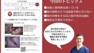 50歳を過ぎたら歯の破折にご用心
