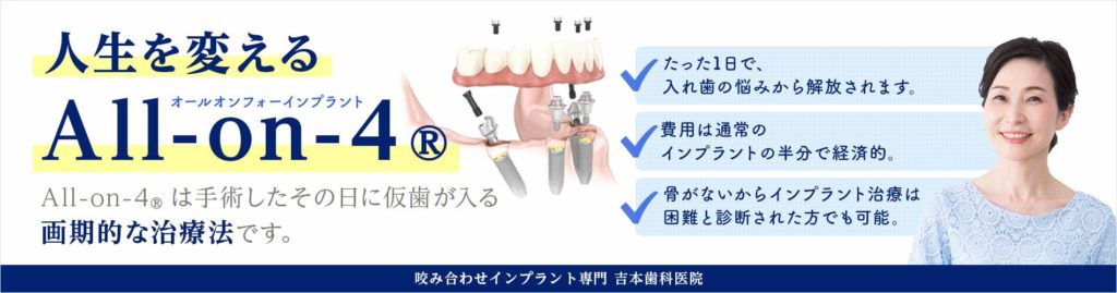 1日で仮歯が入るオールオン4インプラント|香川県高松市の吉本歯科医院|マロクリニック