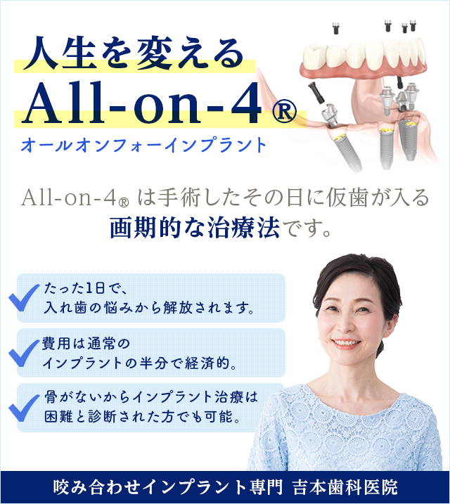 1日で仮歯が入るオールオン4インプラント|香川県高松市の吉本歯科医院|マロクリニック