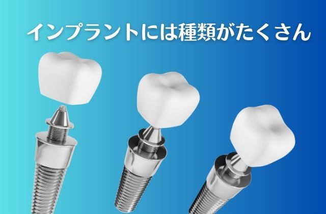 他医院で受けたインプラントの修復・治療・メインテナンスの相談｜高松市の吉本歯科医院