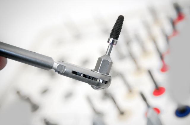 他医院で受けたインプラントの修復・治療・メインテナンスの相談｜高松市の吉本歯科医院