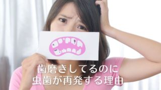 歯磨きしているのに虫歯が再発する理由