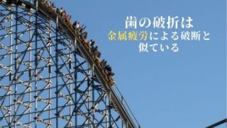 突然の抜歯診断！原因は「歯の破折」