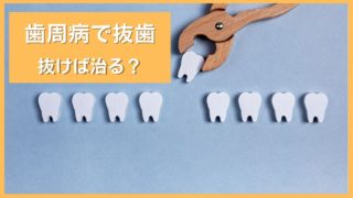 1本だけが歯周病ってあると思いますか？
