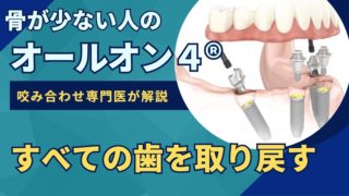 【オールオン４®】4本のインプラントですべての歯を取り戻す