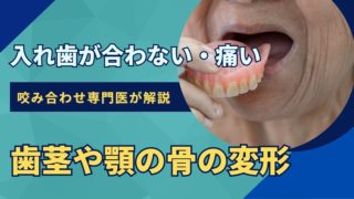 入れ歯が痛い・合わないのは歯茎や顎の変形が原因かもしれません