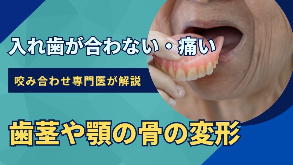入れ歯が痛い・合わないのは歯茎や骨の変形が原因かもしれません｜高松市のインプラントならかみあわせ専門の吉本歯科医院