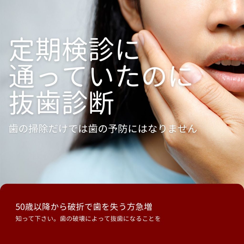 歯根破折で抜歯診断｜高松市のインプラントなら吉本歯科医院
