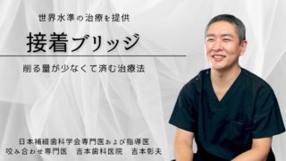 歯を削る量が10分の１程度で済む接着ブリッジで自然な笑顔を取り戻す